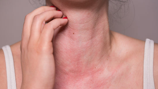 The Allergy Pandemic
